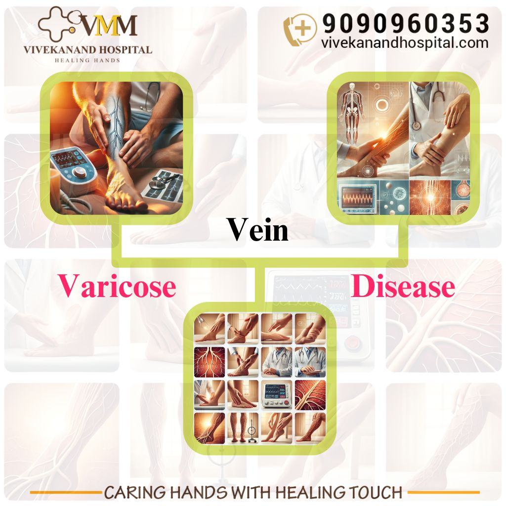 Varicose vein treatment in Bhubaneswar